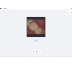 Scanner intraoral digital SmartScan - imagine 7