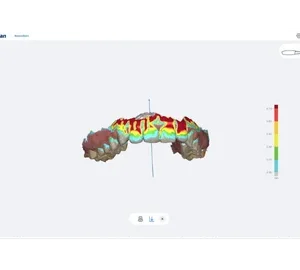 Scanner intraoral digital SmartScan - imagine 3