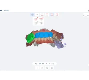 Scanner intraoral digital SmartScan - imagine 6