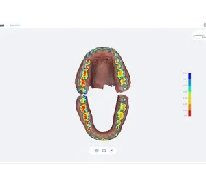 Scanner intraoral digital SmartScan - imagine 5